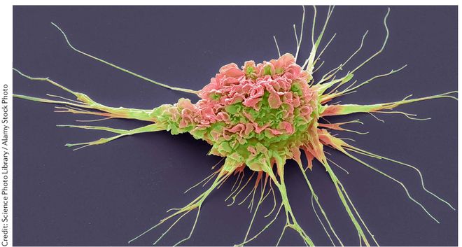 21个疫苗里程碑|从抗击天花到狙击癌症,人类抗疫史太精彩