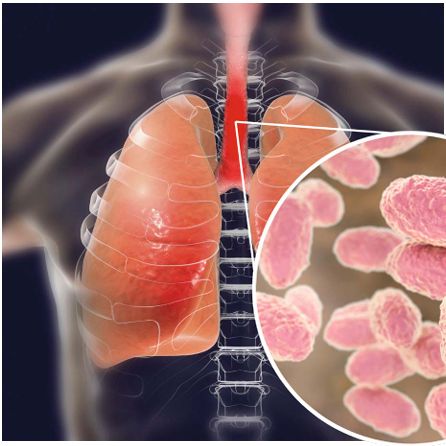 21个疫苗里程碑|从抗击天花到狙击癌症,人类抗疫史太精彩